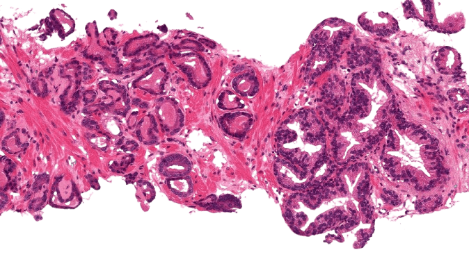 Illustrative digitized prostate H&E tissue
